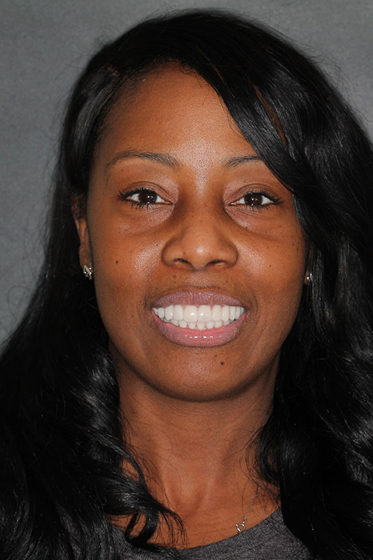 before-after gallery