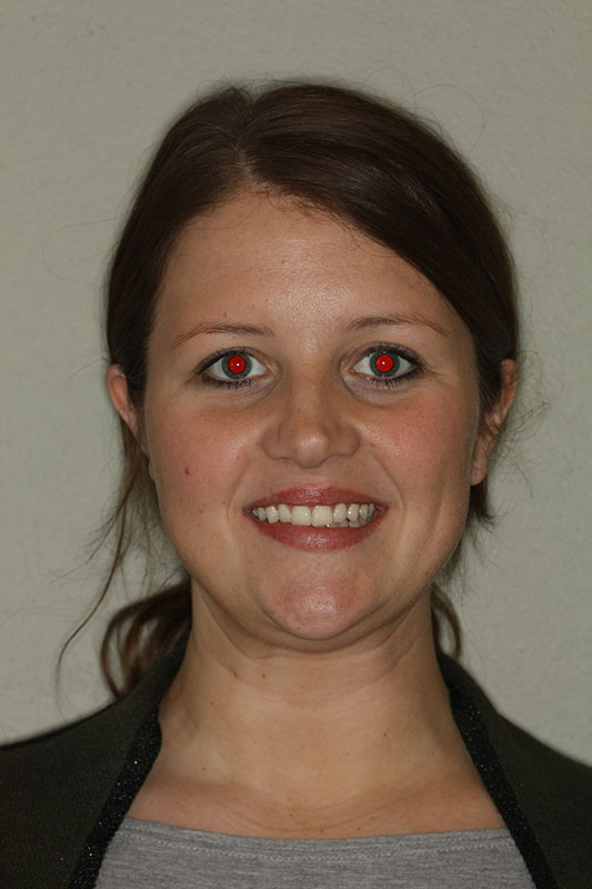 before-after gallery