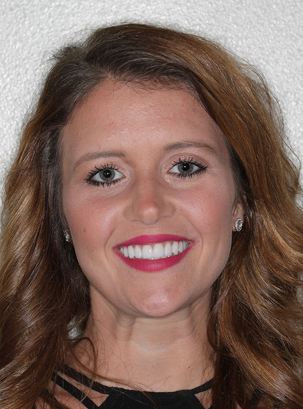 before-after gallery