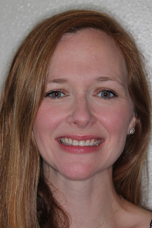 before-after gallery