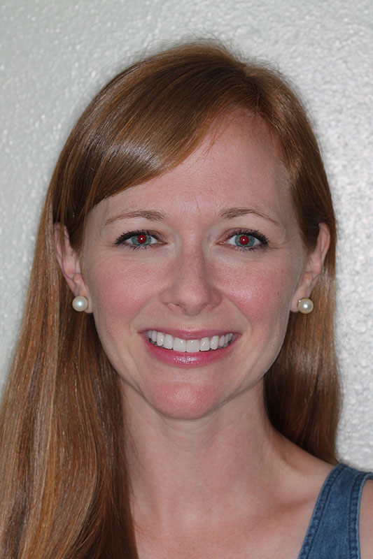 before-after gallery