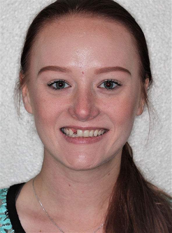 before-after gallery