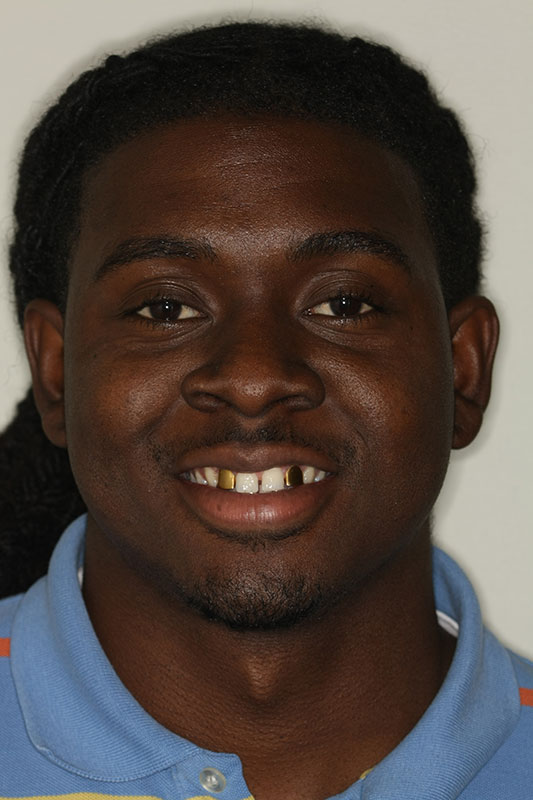 before-after gallery