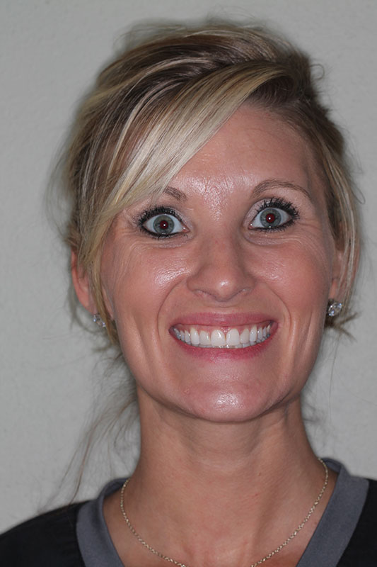 before-after gallery