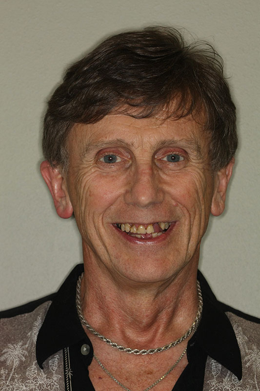 before-after gallery