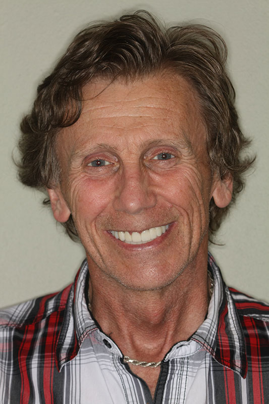 before-after gallery