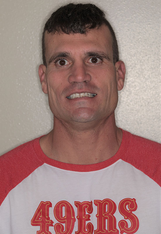 before-after gallery