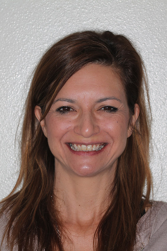 before-after gallery