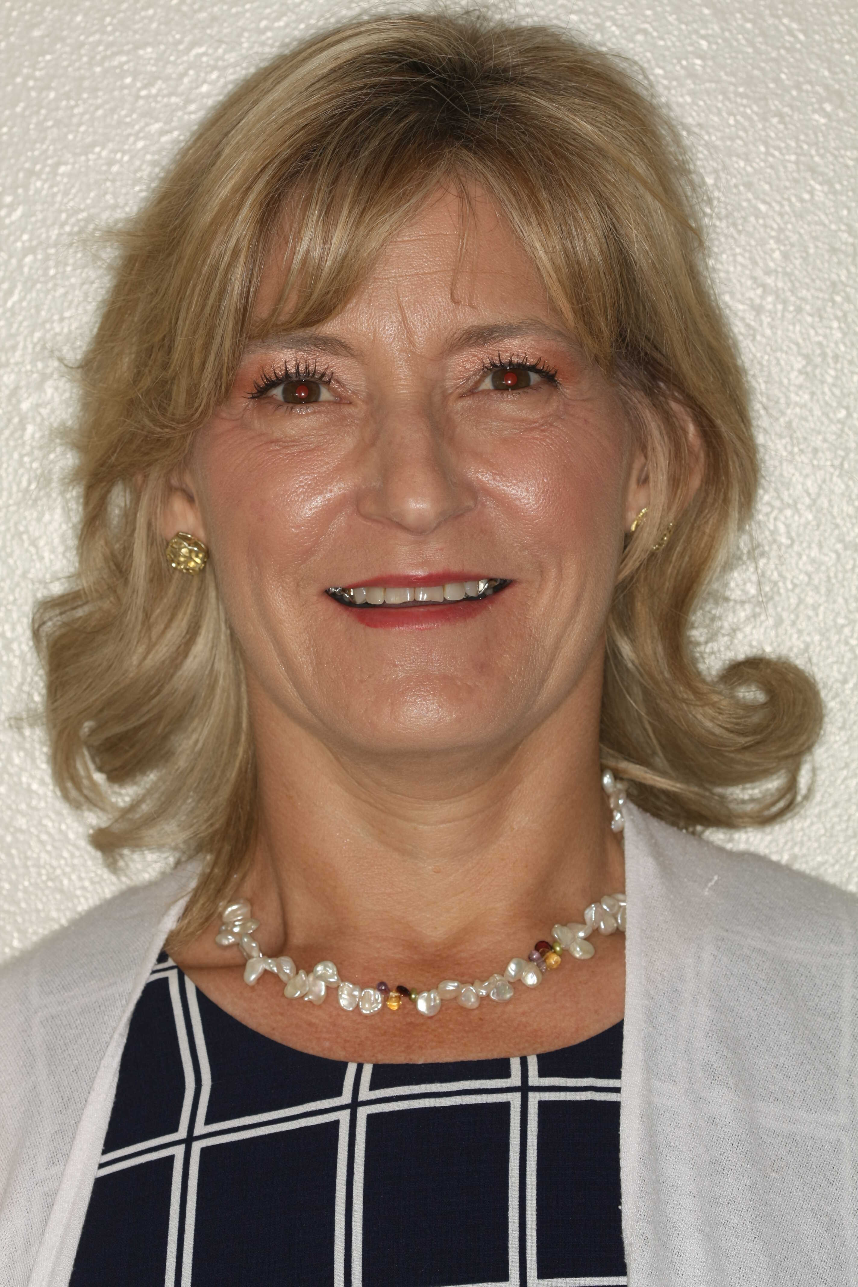 before-after gallery