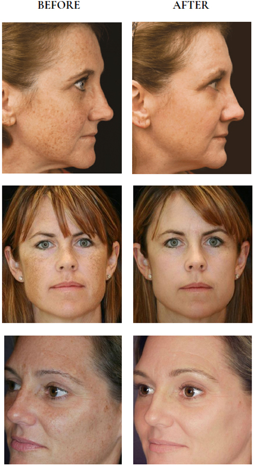 pigmentation graphic